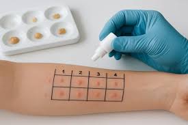 ALLERGY TEST VEG / POLLEN / CONTACTS / DRUG / NON - VEG
